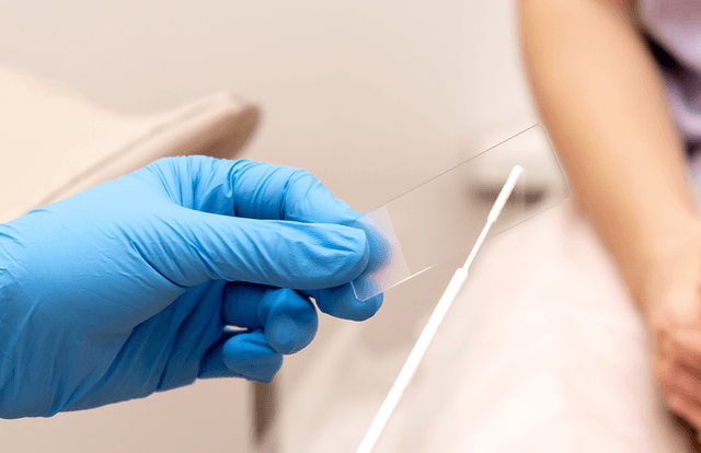  Screening Vital pentru Prevenirea Cancerului de Col Uterin - Viață Sănătoasă cu Depistare Timpurie